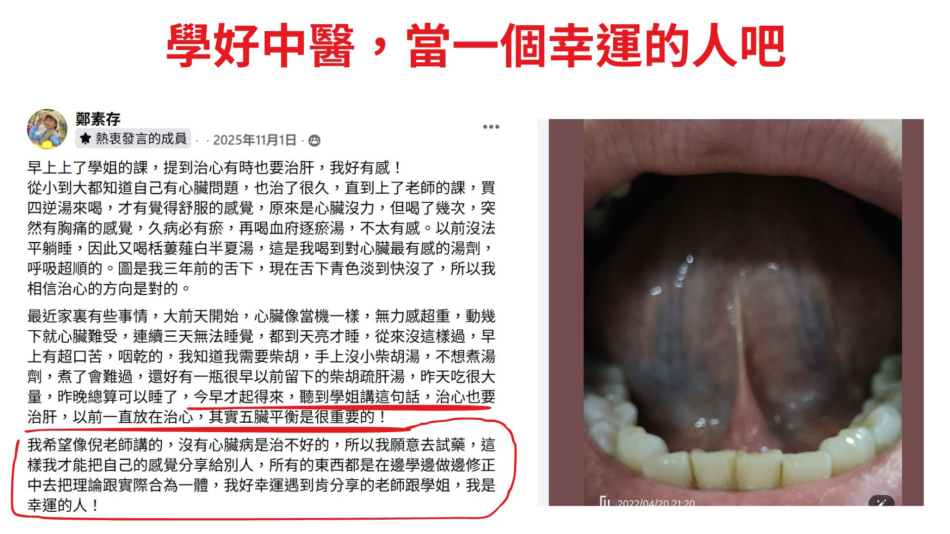 學好中醫,當一個幸運的人吧|經方百日訓練營學員成功案例10
