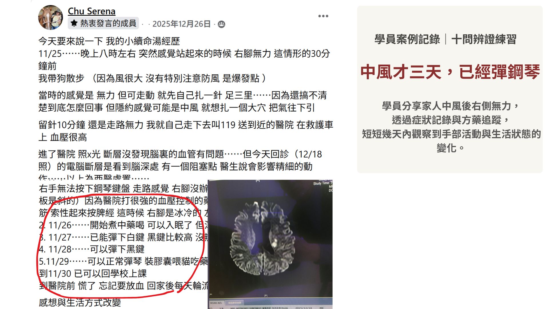 十問辨證練習紀錄|經方百日訓練營學員成功案例02